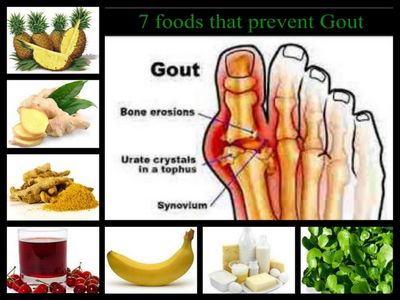 How to Prevent Or Treat Gout purine content