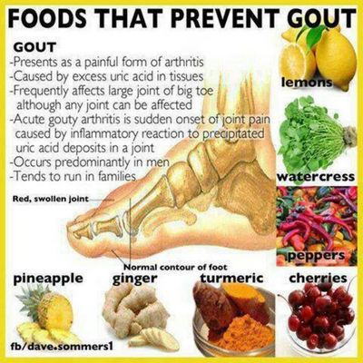 How to Prevent Or Treat Gout But, there are some steps