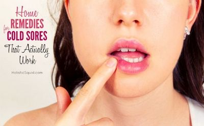 Some Cold Sore Remedies That Actually Work the home remedies available
