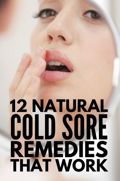 Some Cold Sore Remedies That Actually Work real pain, however with some