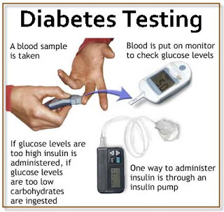 The Tests Used to Diagnose Diabetes you may need to